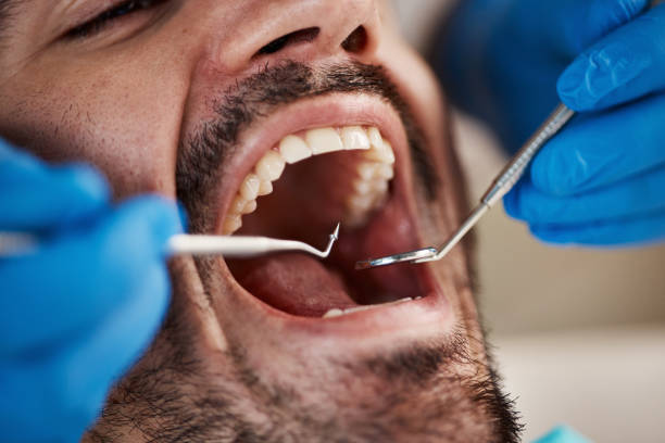 Best Broken Tooth Emergency  in Stevenson, WA
